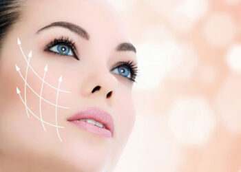 لیفت صورت در لایه SMAS با اندولیفت