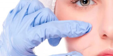 تزریق چربی نانوفت با سلول های بنیادی برای جوانسازی