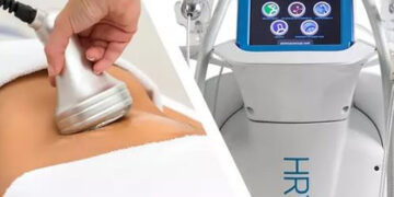 بوتاکس لاغری یا کویتیشن