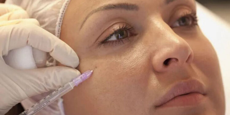 مزوژل جوانساز صورت سیتوکر