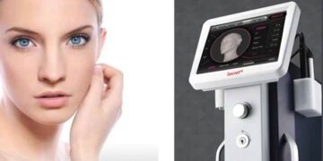 رفع چین و چروک با دستگاه سیکرت دو