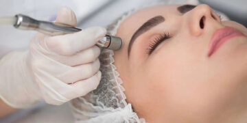 میکرودرم صورت چیست