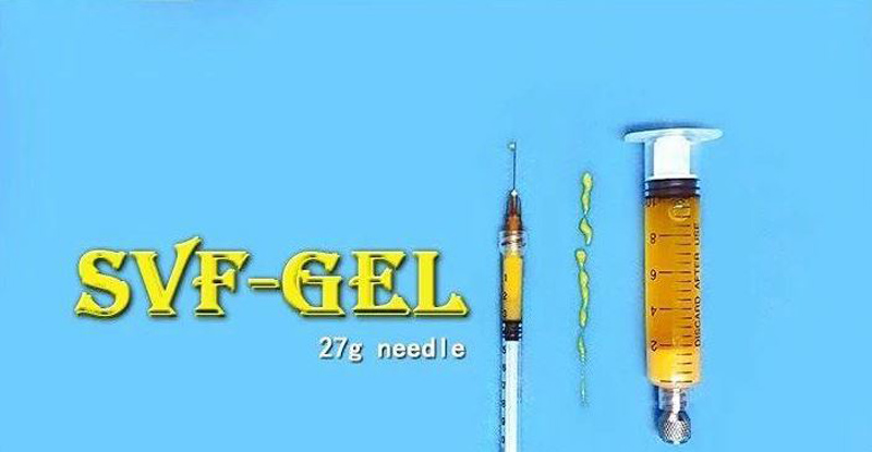 اس وی اف ژل متد جوانسازی جدید