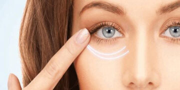 جایگزین بوتاکس برای چروک دور چشم