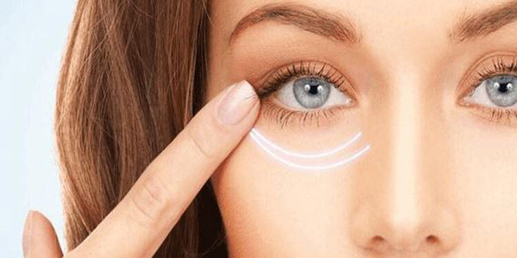 جایگزین بوتاکس برای چروک دور چشم