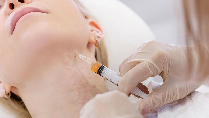 درمان خانگی لاغری صورت