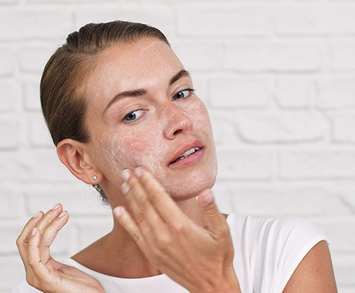 فیشیال صورت بهتر است یا لایه برداری