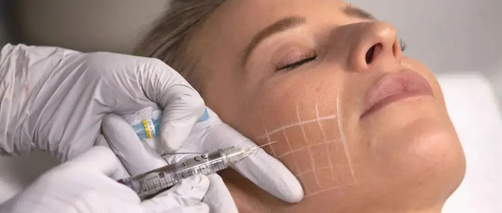 مزوتراپی برای لاغری صورت