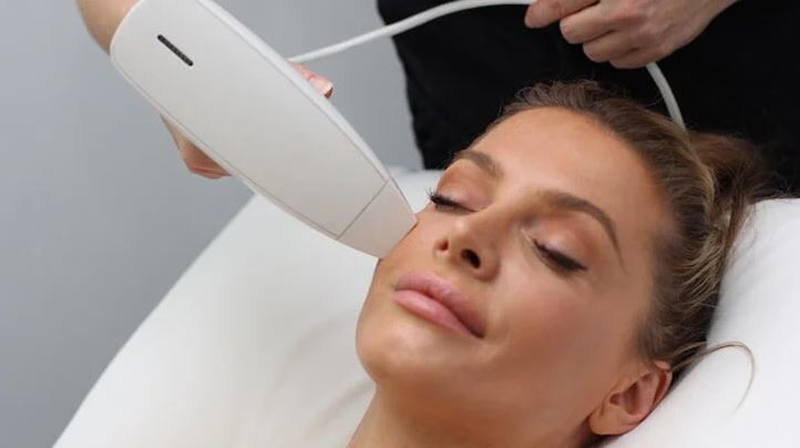 نانو آر اف فرکشنال صورت