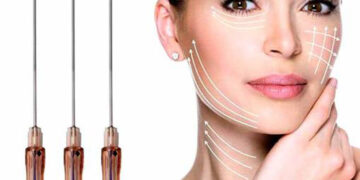 انواع نخ لیفت صورت