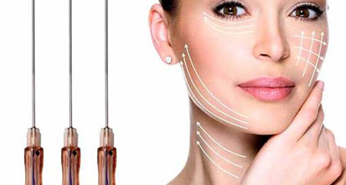 انواع نخ لیفت صورت