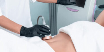 لاغری با لیزر بدون جراحی