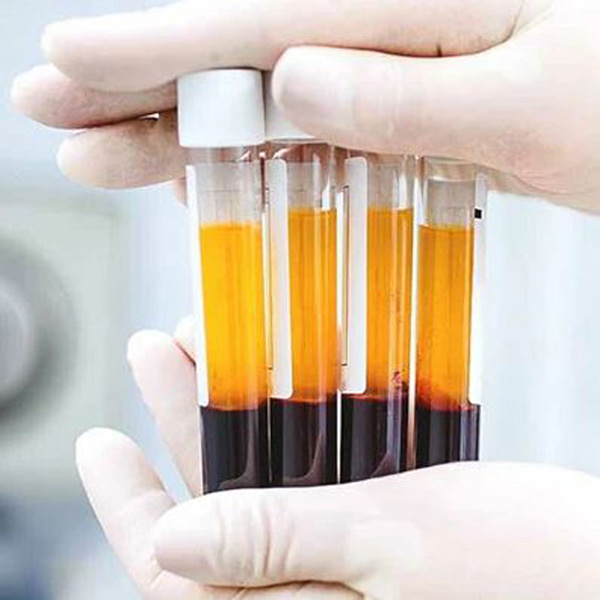 کرم پی آر پی لیپوزومال روش نوین جوانسازی