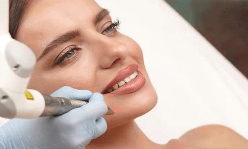 اربیوم صورت