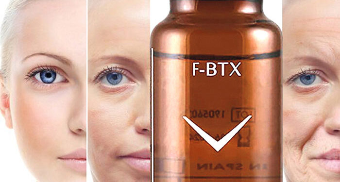 شبه بوتاکس