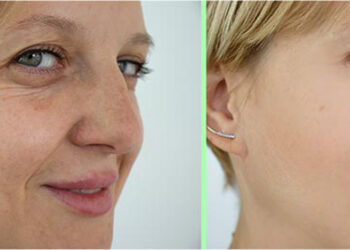 بادیان برای چروک صورت