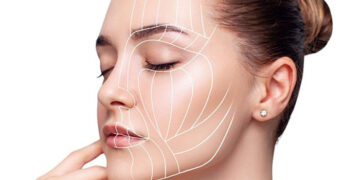 اندوتاین صورت