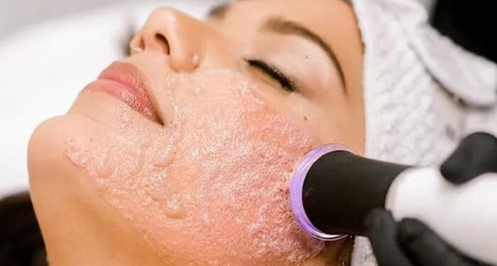 پلاژن تراپی صورت