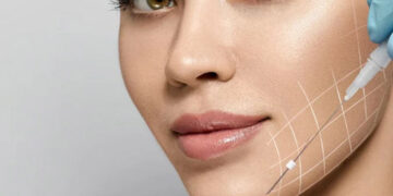 نخ جوانسازی و لیفت صورت