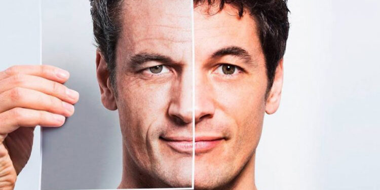 جلوگیری از چین و چروک صورت