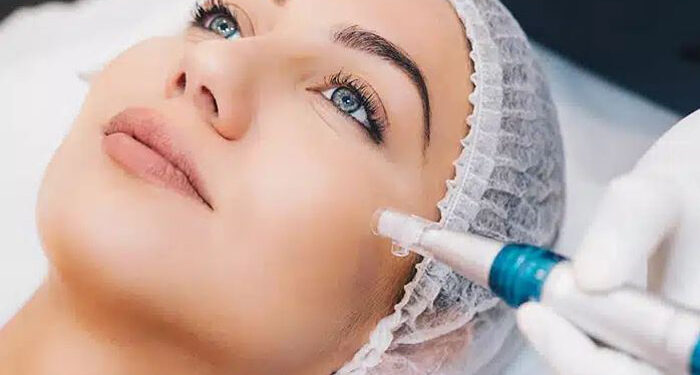 تیکسل یا میکرونیدلینگ