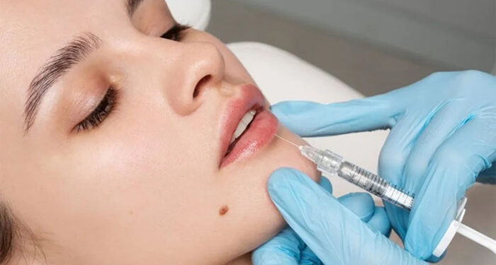 عوارض فیلر چیست