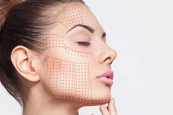 مادلینگ صورت