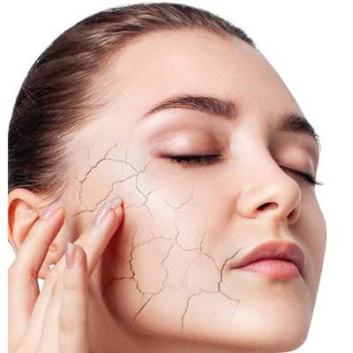 درمان چروک صورت فوری
