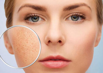 بستن منافذ باز پوست