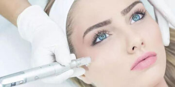 بهترین میکرونیدلینگ