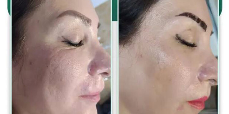 جوانساز پروسترولین