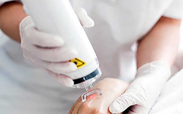 جوانسازی پوست دست با لیزر