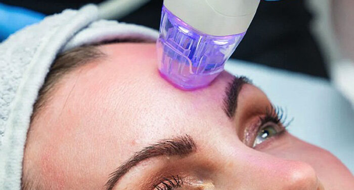 آر اف ویرچو برای احیای پوست