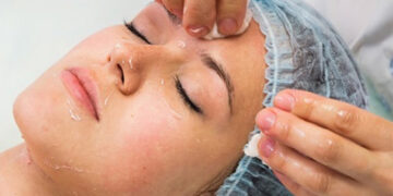 اسید تراپی پوست