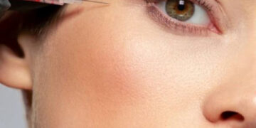 فرق مزوژل با فیلر زیر چشم