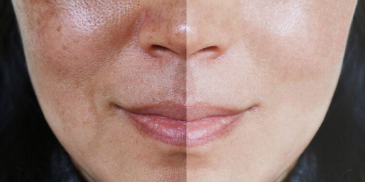 سرم روشن کننده پوست