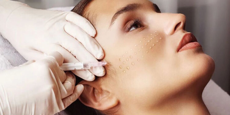 خاصیت مزوتراپی صورت