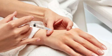 تزریق ژل به پشت دست