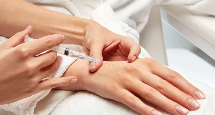 تزریق ژل به پشت دست