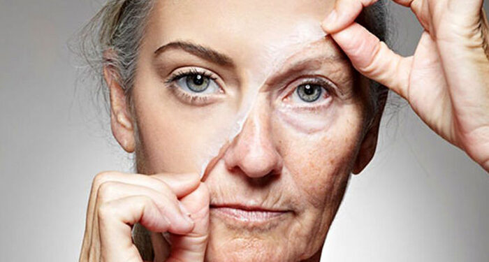 درمان چروک صورت فوری