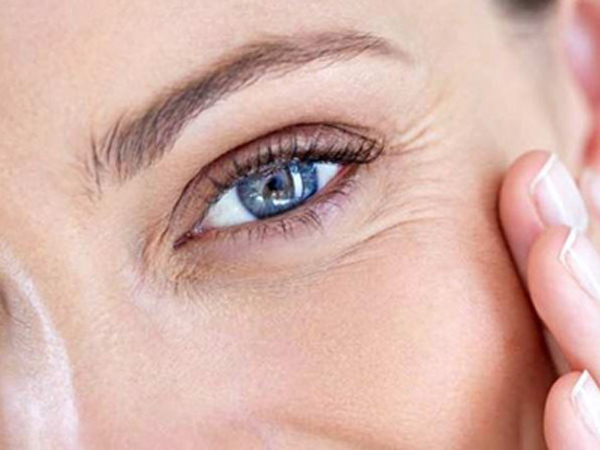 چروک زیر چشم موقع خندیدن