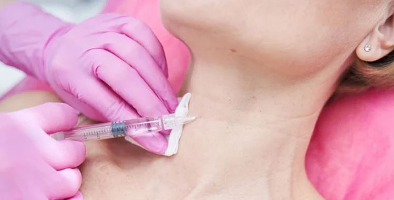 جوانسازی گردن با مزوژل