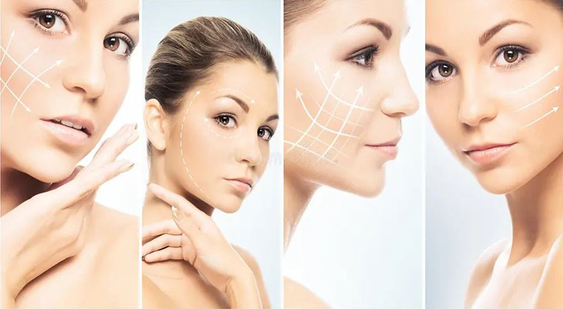 انواع لیفت صورت