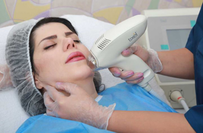 تیکسل یا میکرونیدلینگ