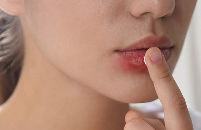 عوارض فیلر چیست