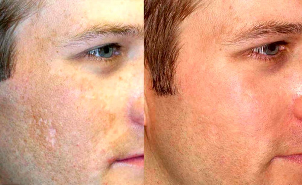 کلاژن پوست صورت چیست