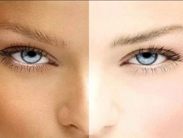 روشن کردن پوست صورت