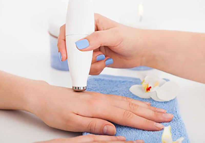 جوانسازی پوست دست با لیزر