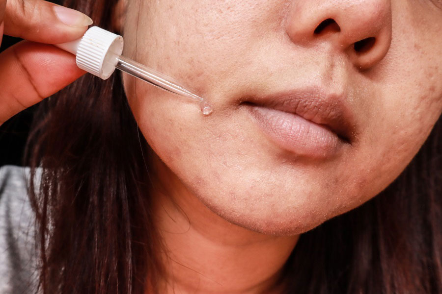 سرم روشن کننده پوست