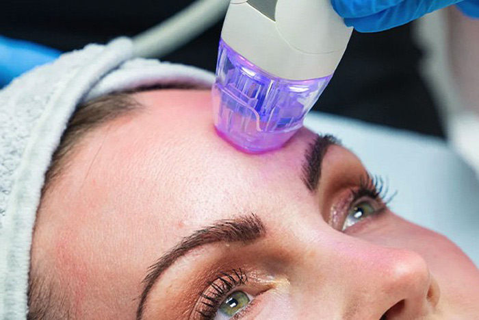 جدیدترین تکنولوژی جوانسازی آر اف ویرچو